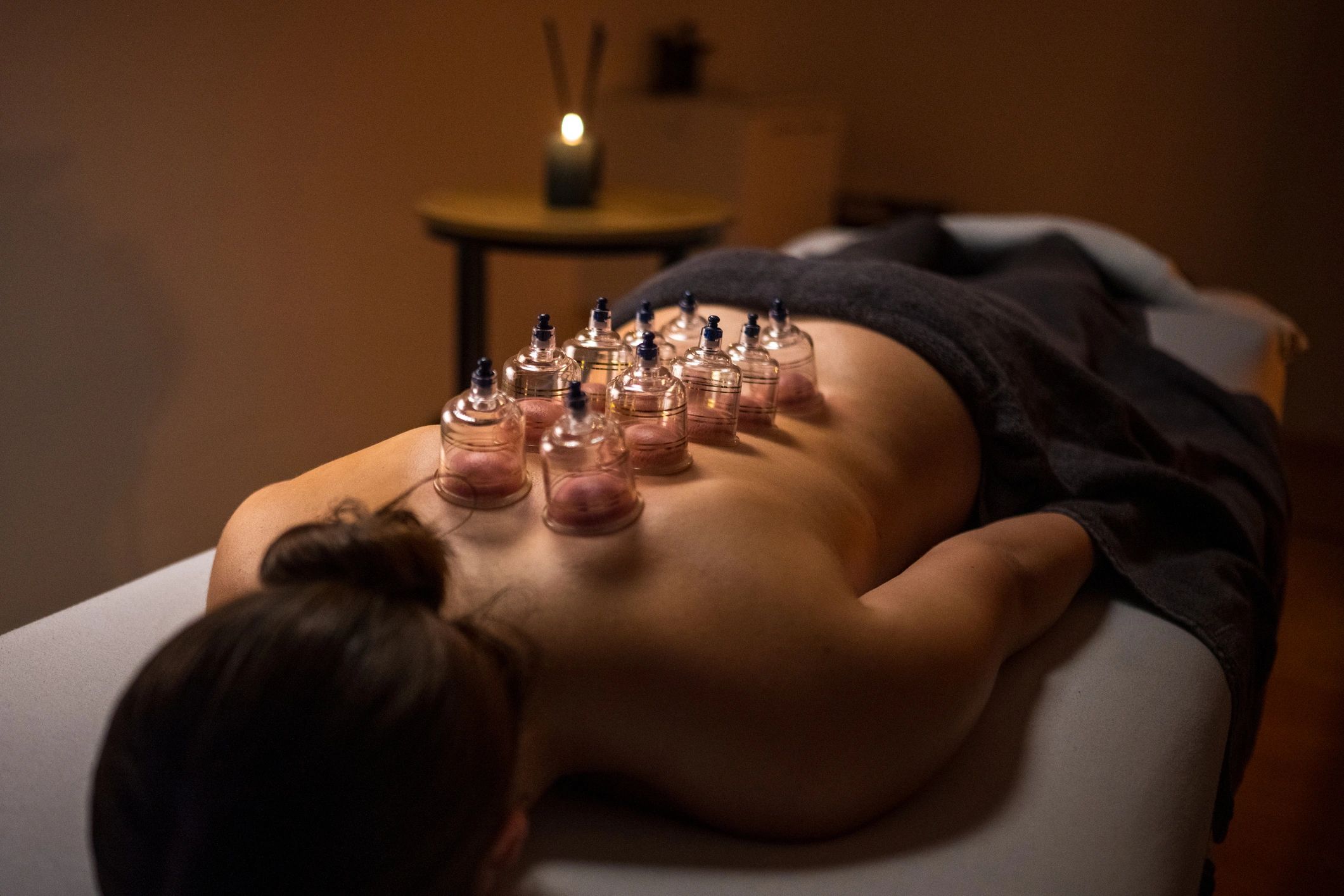 Woman Receiving Cupping Therapy in Dimly Lit Room